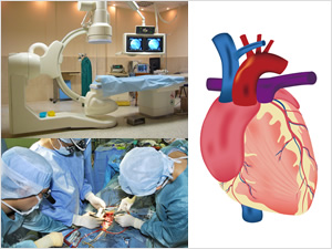 循環器内科・心臓血管外科とは